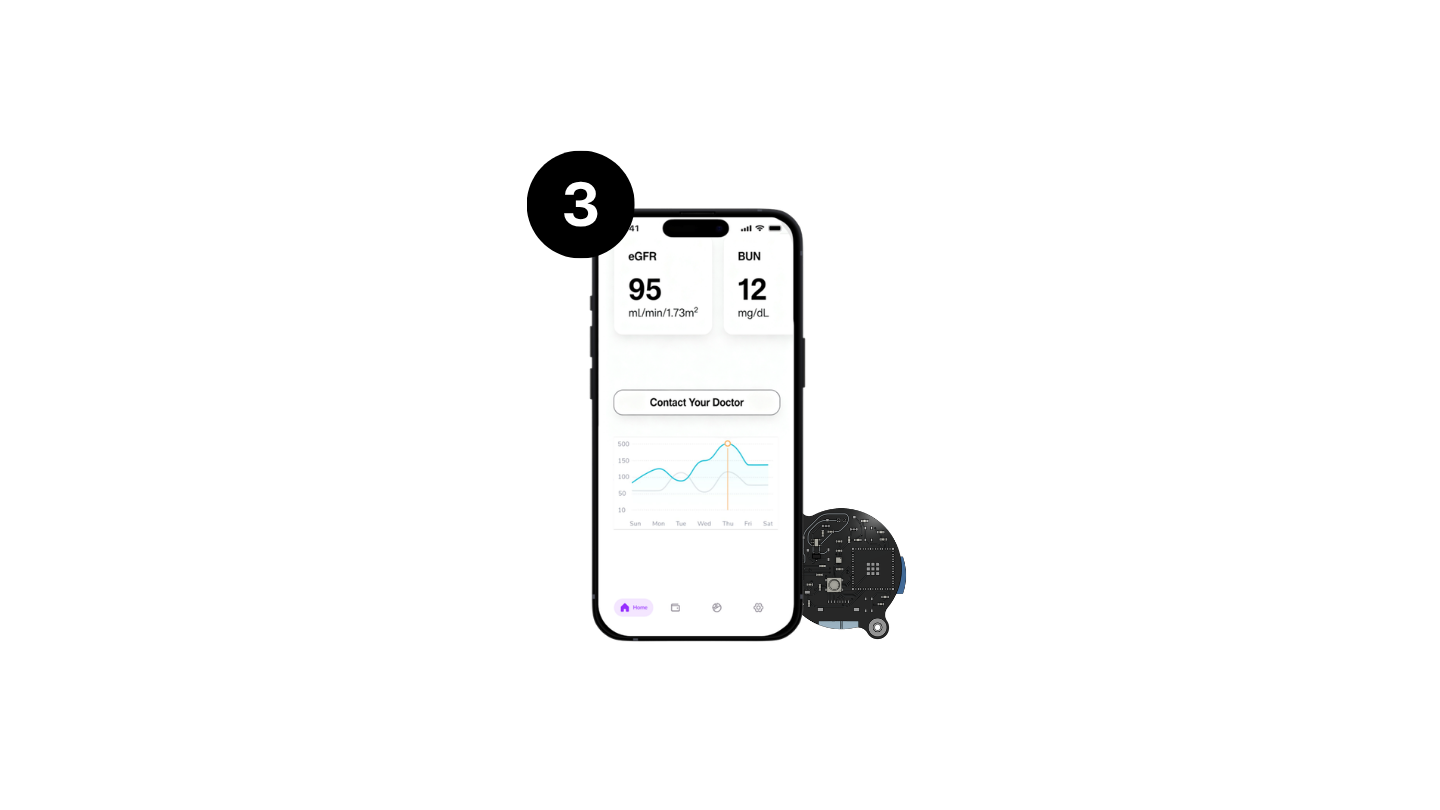 Reviewing IISENSE kidney health results